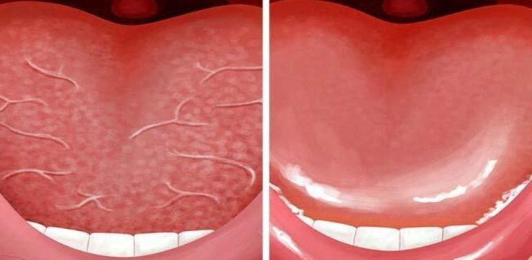 6 Möglichkeiten, Mundgeruch auch nach dem Aufwachen zu vermeiden